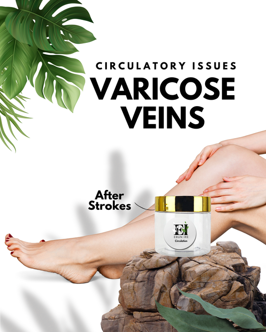 Varicose Veins Remedy Cream